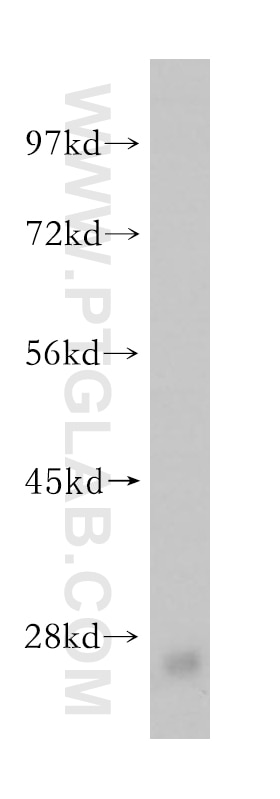 Western Blot (WB) analysis of mouse skeletal muscle tissue using IgG Kappa Light Chain Polyclonal antibody (14678-1-AP)