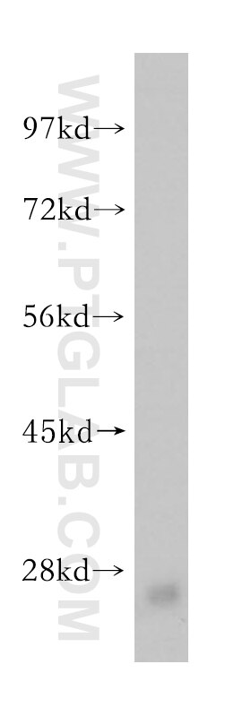 WB analysis of mouse skeletal muscle using 14678-1-AP