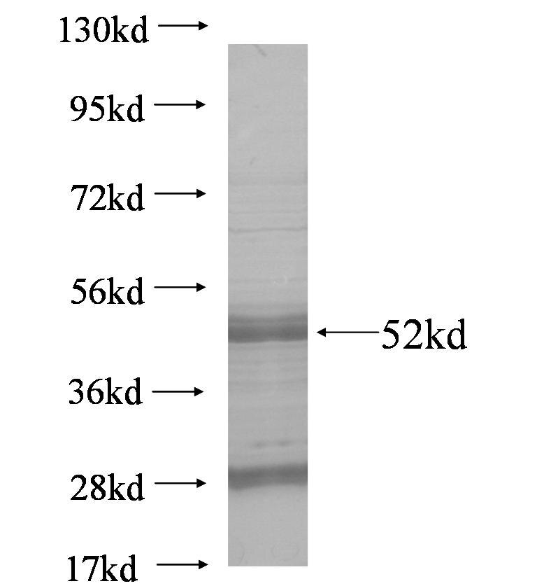 IGK- fusion protein Ag6389 SDS-PAGE