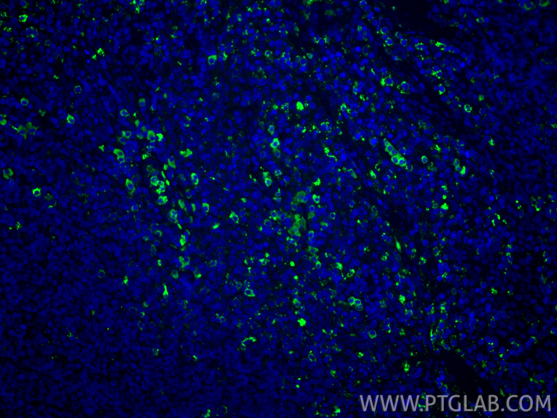 Immunofluorescence (IF) / fluorescent staining of human tonsillitis tissue using IgG Kappa Light Chain Polyclonal antibody (11781-1-AP)
