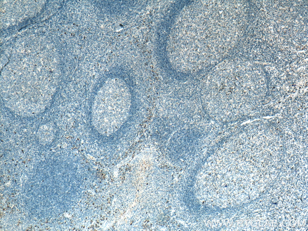 Immunohistochemistry (IHC) staining of human tonsillitis tissue using IgG Kappa Light Chain Polyclonal antibody (11781-1-AP)