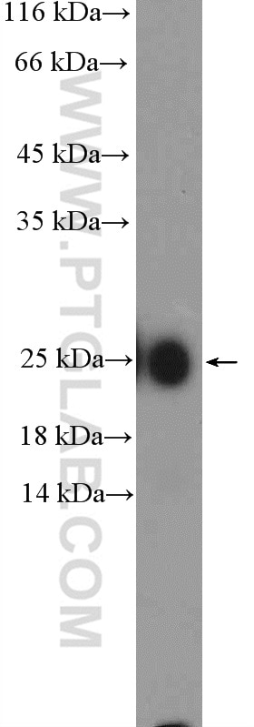 WB analysis of human plasma using 11781-1-AP