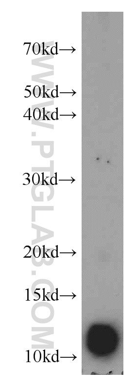 WB analysis of mouse spleen using 11781-1-AP