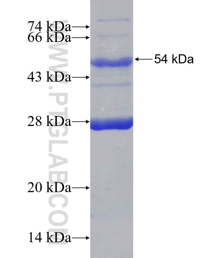 IGKV1-5 fusion protein Ag2406 SDS-PAGE