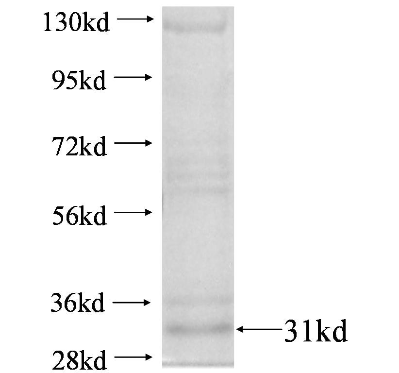 IGKV1-5 fusion protein Ag4378 SDS-PAGE IGKV1-5 fusion protein Ag4378 SDS-PAGE