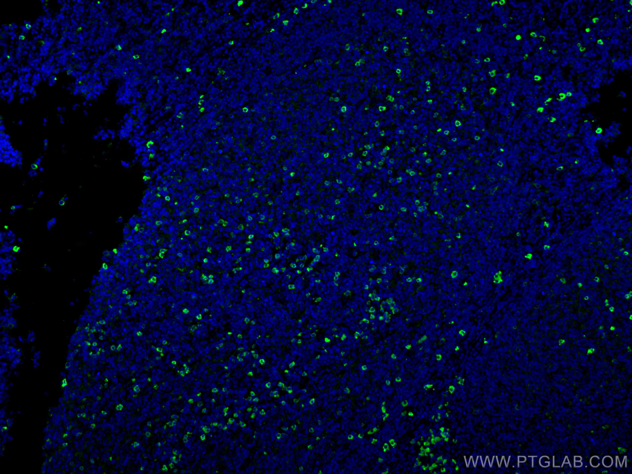 Immunofluorescence (IF) / fluorescent staining of human tonsillitis tissue using IgG Lambda Light Chain Polyclonal antibody (11541-1-AP)
