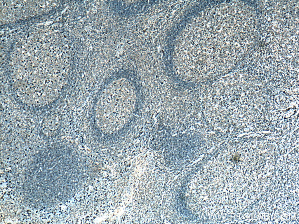 Immunohistochemistry (IHC) staining of human tonsillitis tissue using IgG Lambda Light Chain Polyclonal antibody (11541-1-AP)