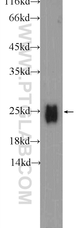 WB analysis of human spleen using 11541-1-AP