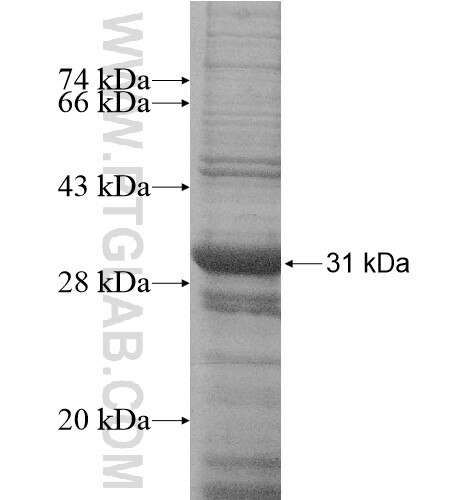 IGLC1 fusion protein Ag14783 SDS-PAGE