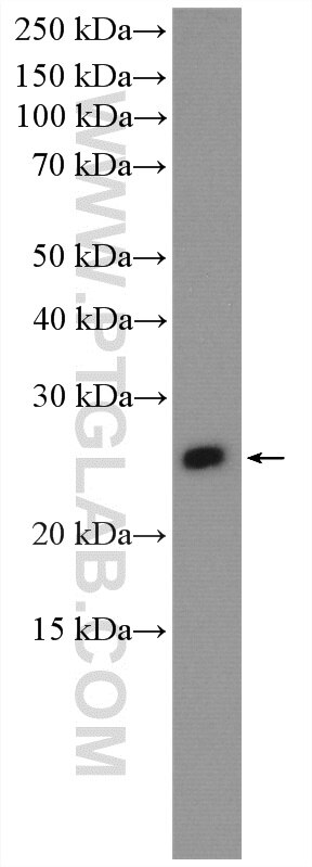Western Blot (WB) analysis of various lysates using IGLV6-57 Polyclonal antibody (18344-1-AP)