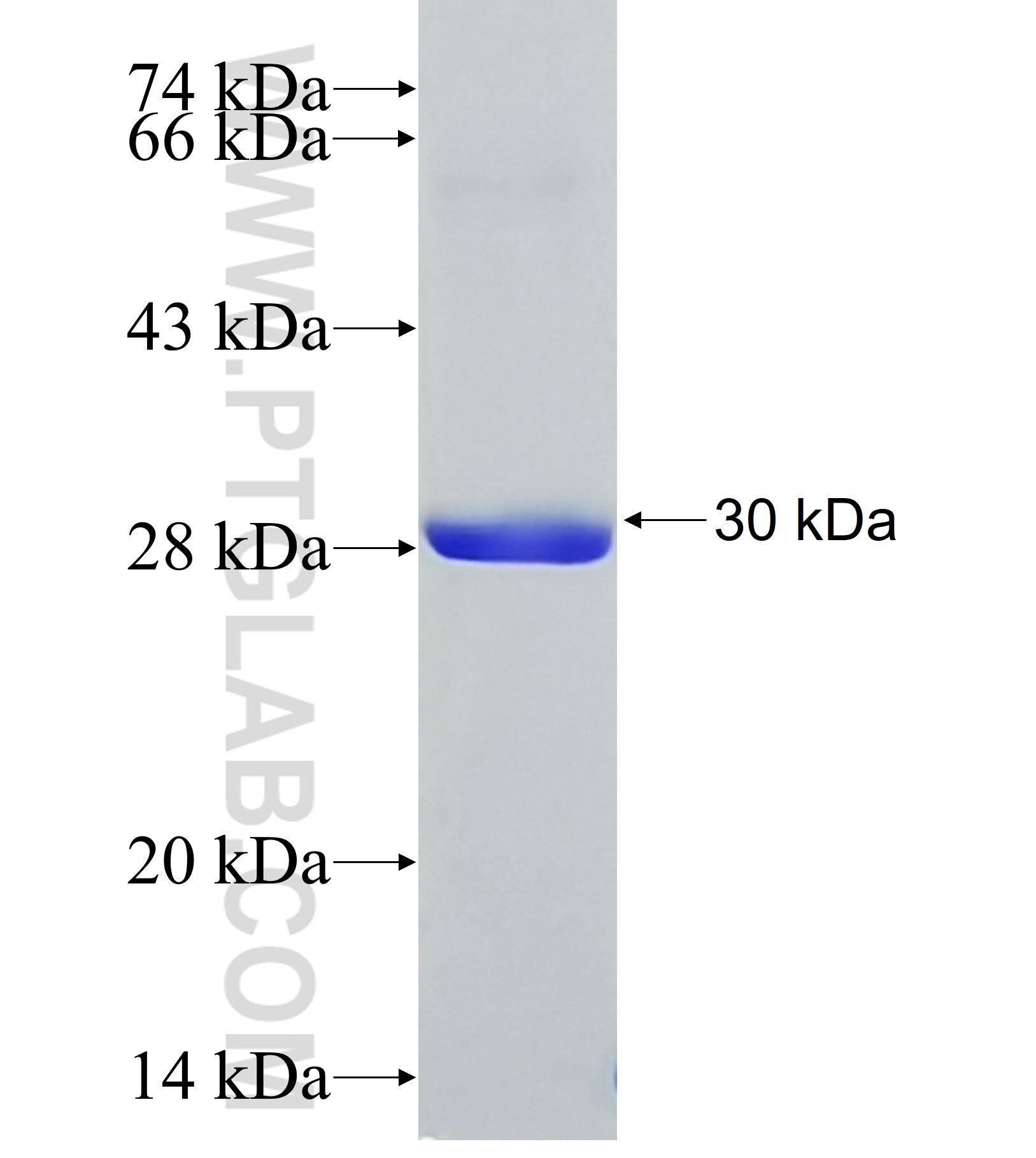 IGSF10 fusion protein Ag37158 SDS-PAGE IGSF10 fusion protein Ag37158 SDS-PAGE