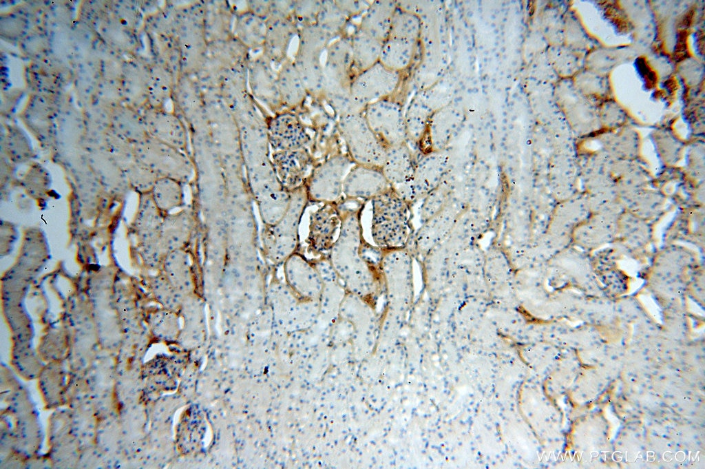 Immunohistochemistry (IHC) staining of human kidney tissue using IGSF11 Polyclonal antibody (14003-1-AP)