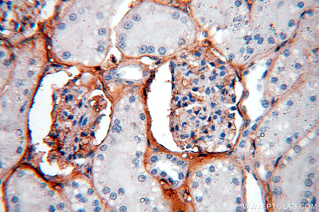 Immunohistochemistry (IHC) staining of human kidney tissue using IGSF11 Polyclonal antibody (14003-1-AP)