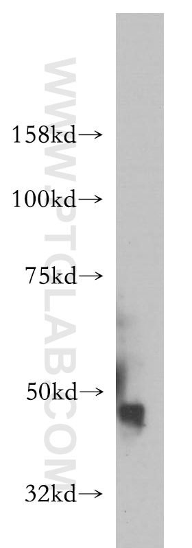 Western Blot (WB) analysis of human brain tissue using IGSF11 Polyclonal antibody (14003-1-AP)