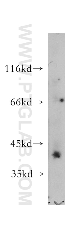 Western Blot (WB) analysis of mouse skeletal muscle tissue using IGSF11 Polyclonal antibody (14003-1-AP)