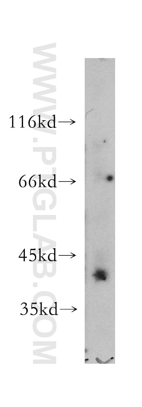 WB analysis of mouse skeletal muscle using 14003-1-AP