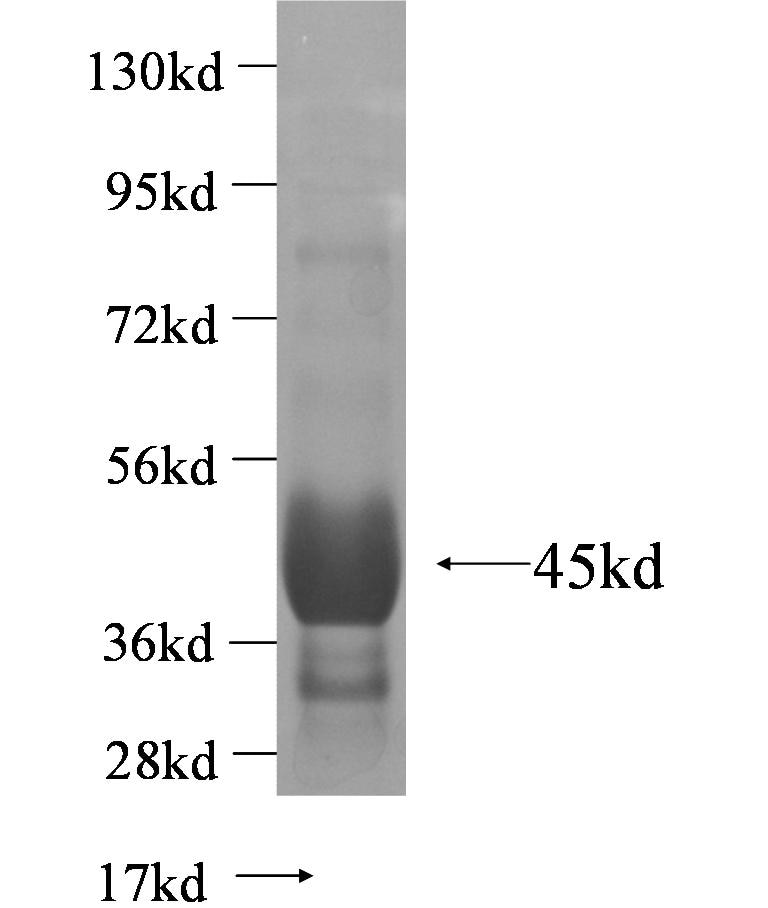 IGSF11 fusion protein Ag5094 SDS-PAGE