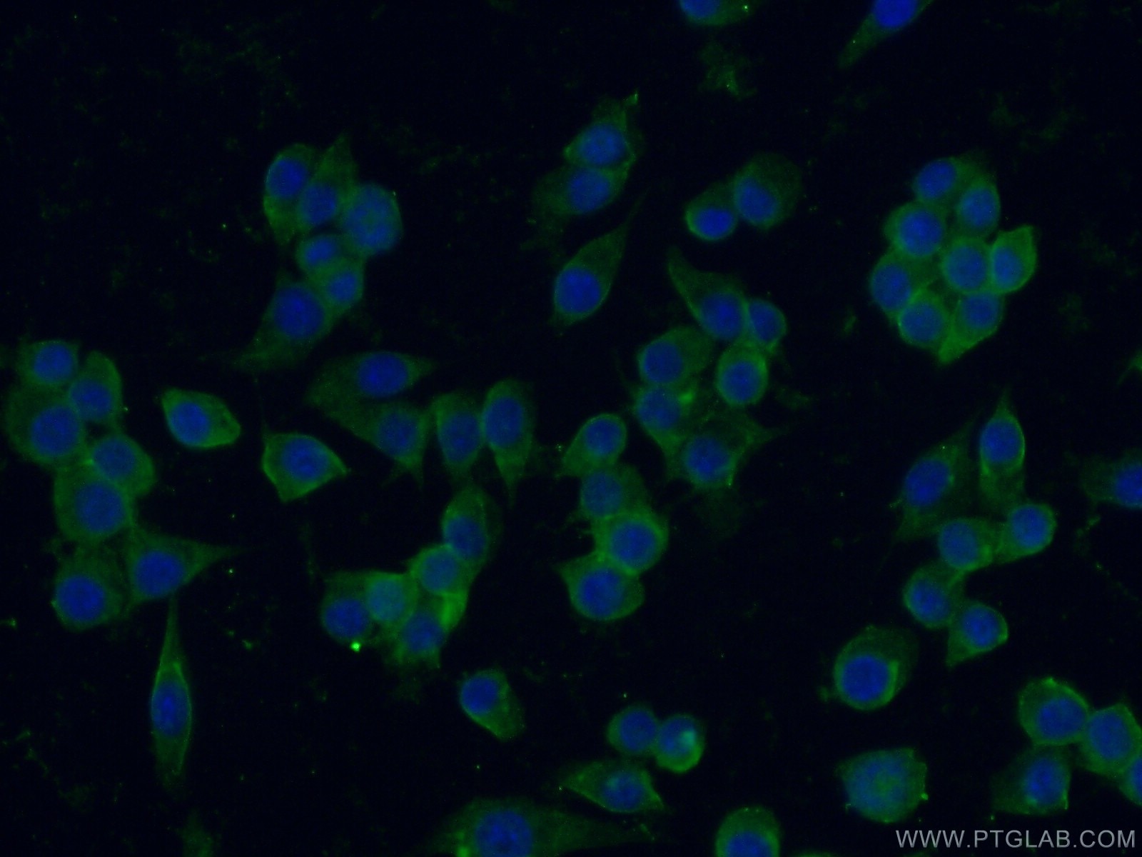 Immunofluorescence (IF) / fluorescent staining of RAW 264.7 cells using IGSF2/CD101 Polyclonal antibody (26047-1-AP)