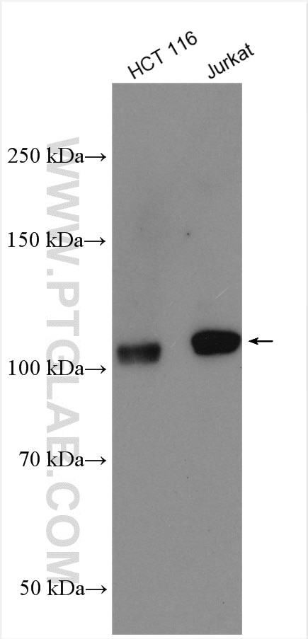 Western Blot (WB) analysis of various lysates using IGSF2 Polyclonal antibody (26047-1-AP)