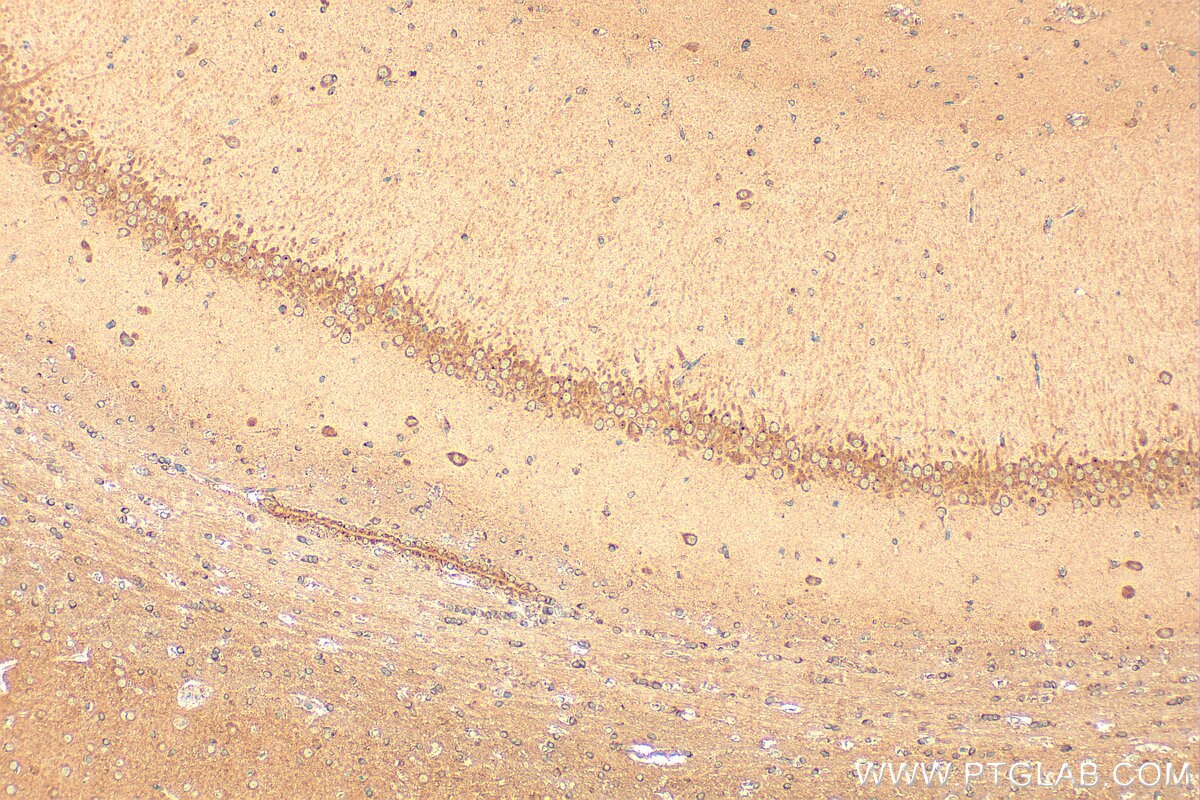 Immunohistochemistry (IHC) staining of rat brain tissue using IGSF21 Polyclonal antibody (21465-1-AP)