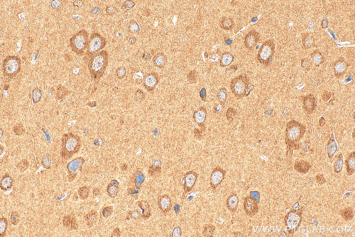 Immunohistochemistry (IHC) staining of rat brain tissue using IGSF21 Polyclonal antibody (21465-1-AP)