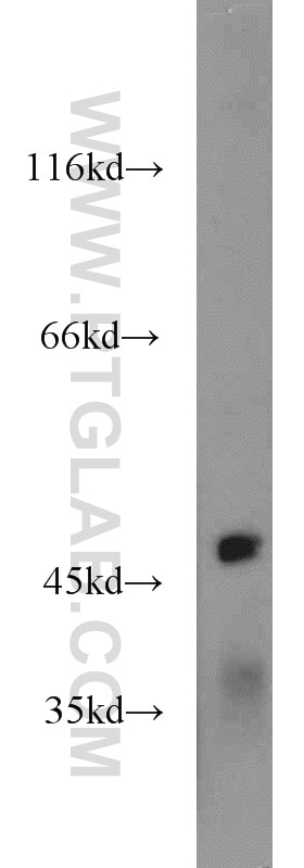 Western Blot (WB) analysis of mouse brain tissue using IGSF21 Polyclonal antibody (21465-1-AP)