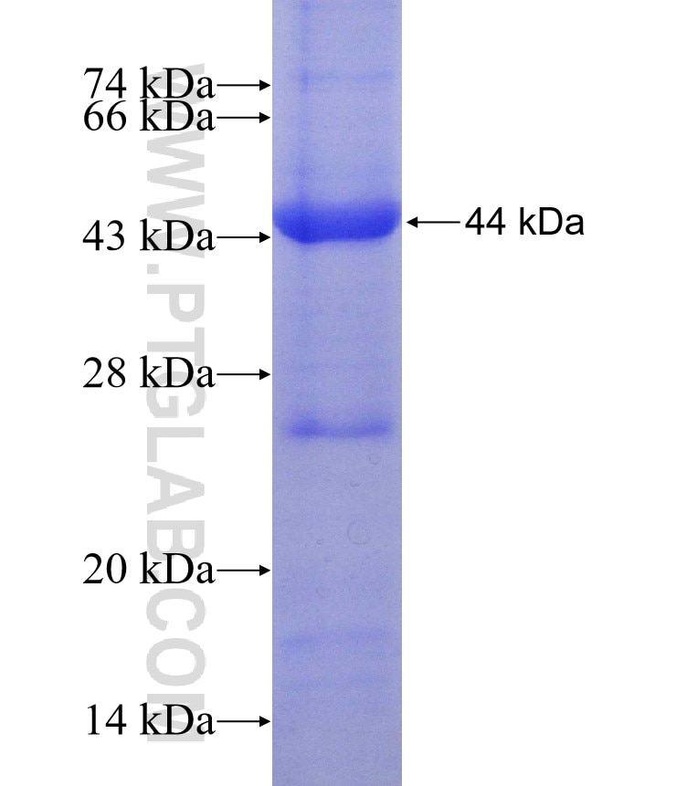IGSF21 fusion protein Ag15062 SDS-PAGE