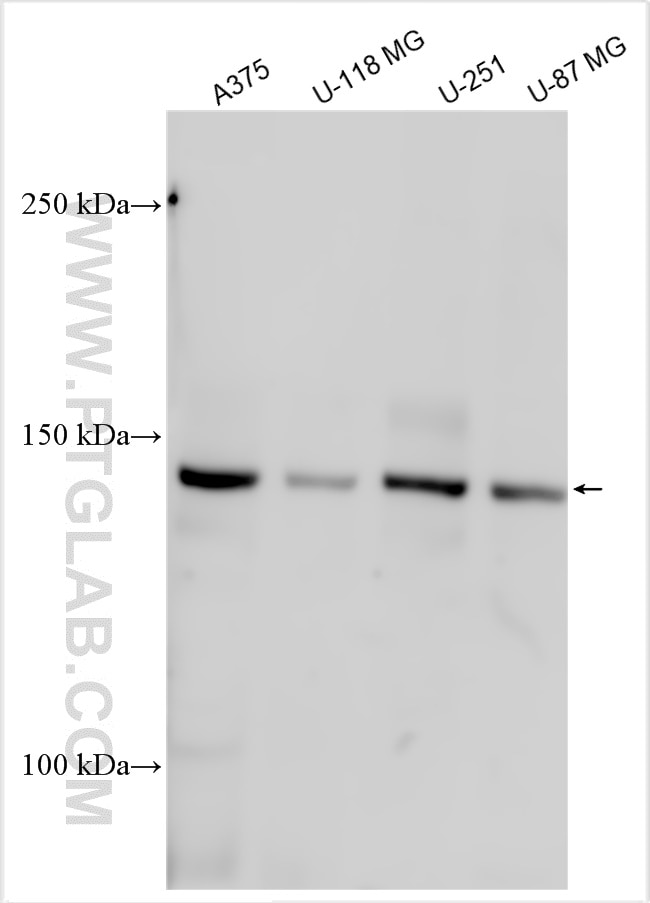 Western Blot (WB) analysis of various lysates using IGSF3 Polyclonal antibody (18072-1-AP)