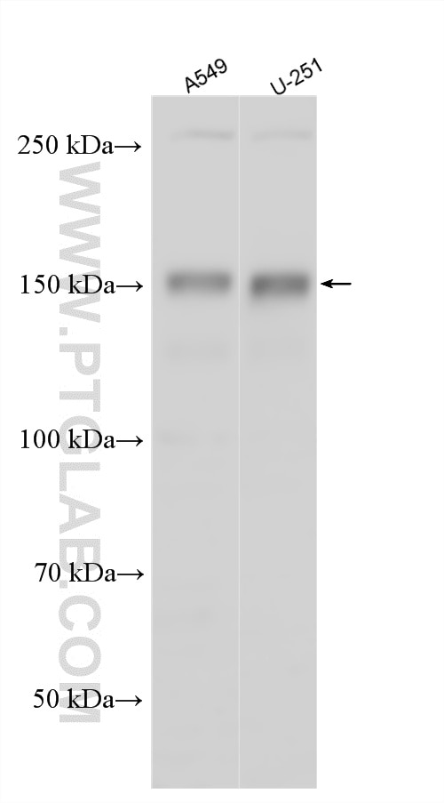 WB analysis using 18072-1-AP Western Blot (WB) analysis of various lysates using IGSF3 Polyclonal antibody (18072-1-AP)