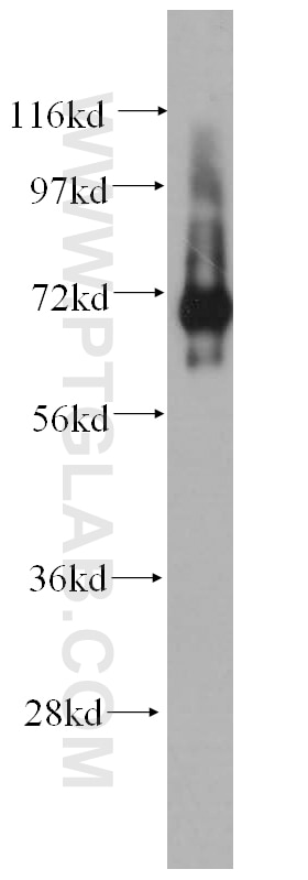 Western Blot (WB) analysis of mouse brain tissue using IGSF8/CD316 Polyclonal antibody (14387-1-AP)
