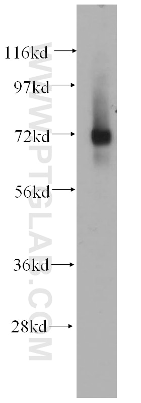 Western Blot (WB) analysis of K-562 cells using IGSF8/CD316 Polyclonal antibody (14387-1-AP)