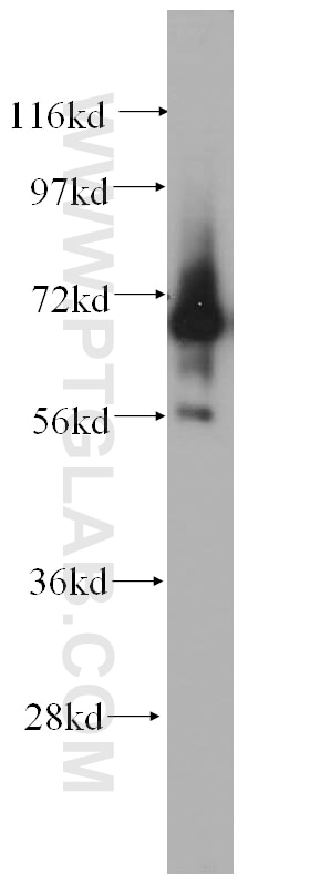 Western Blot (WB) analysis of HEK-293 cells using IGSF8/CD316 Polyclonal antibody (14387-1-AP)