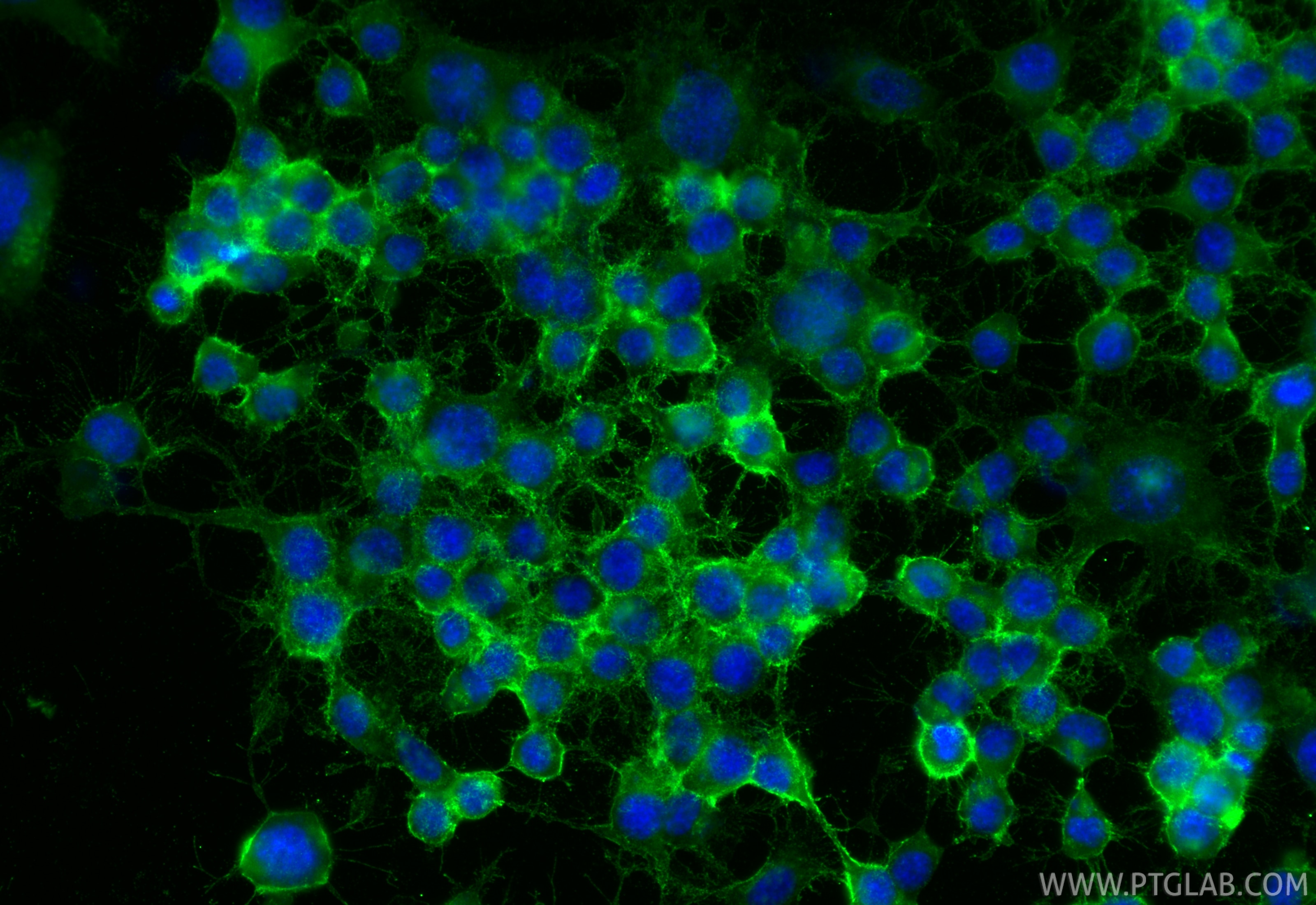 Immunofluorescence (IF) / fluorescent staining of Neuro-2a cells using IGSF8/CD316 Polyclonal antibody (33948-1-AP)