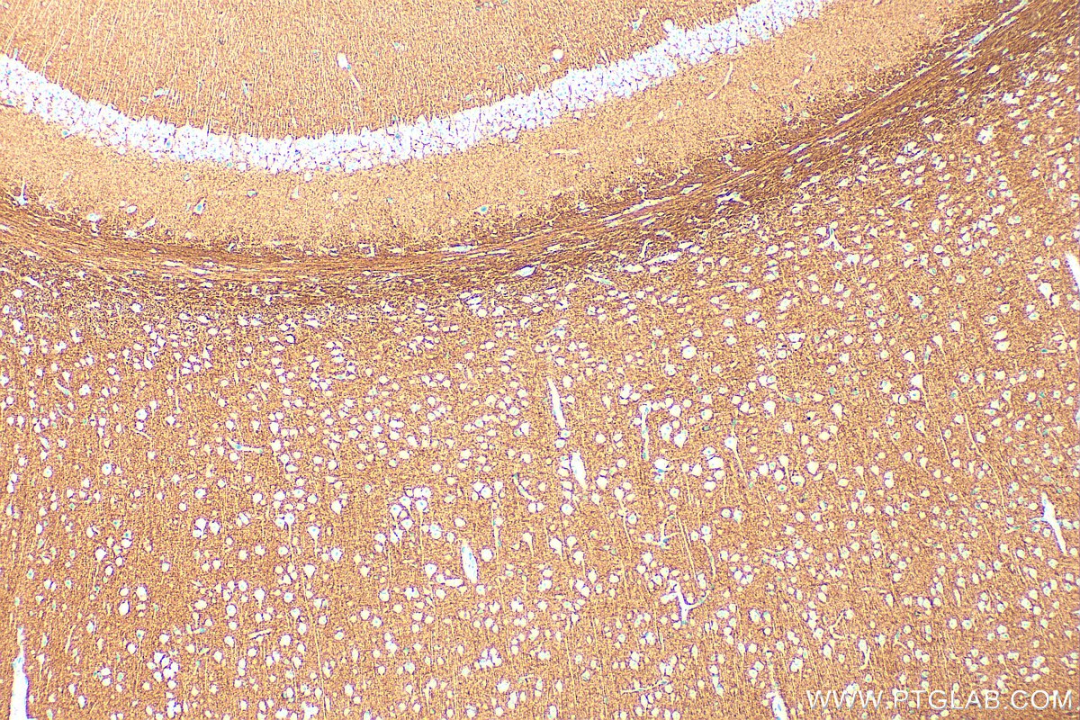 Immunohistochemistry (IHC) staining of mouse brain tissue using IGSF8/CD316 Polyclonal antibody (33948-1-AP)