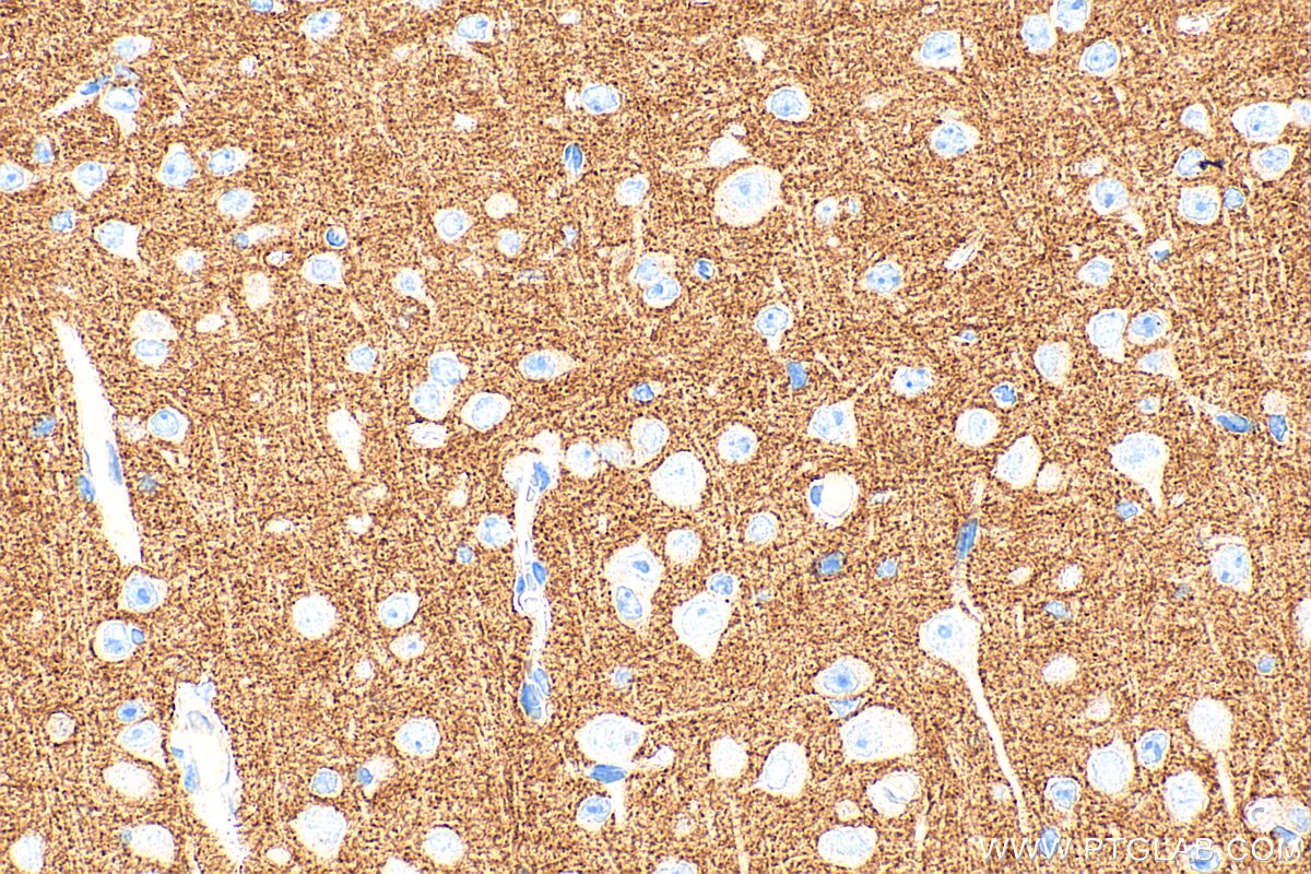 Immunohistochemistry (IHC) staining of mouse brain tissue using IGSF8/CD316 Polyclonal antibody (33948-1-AP)