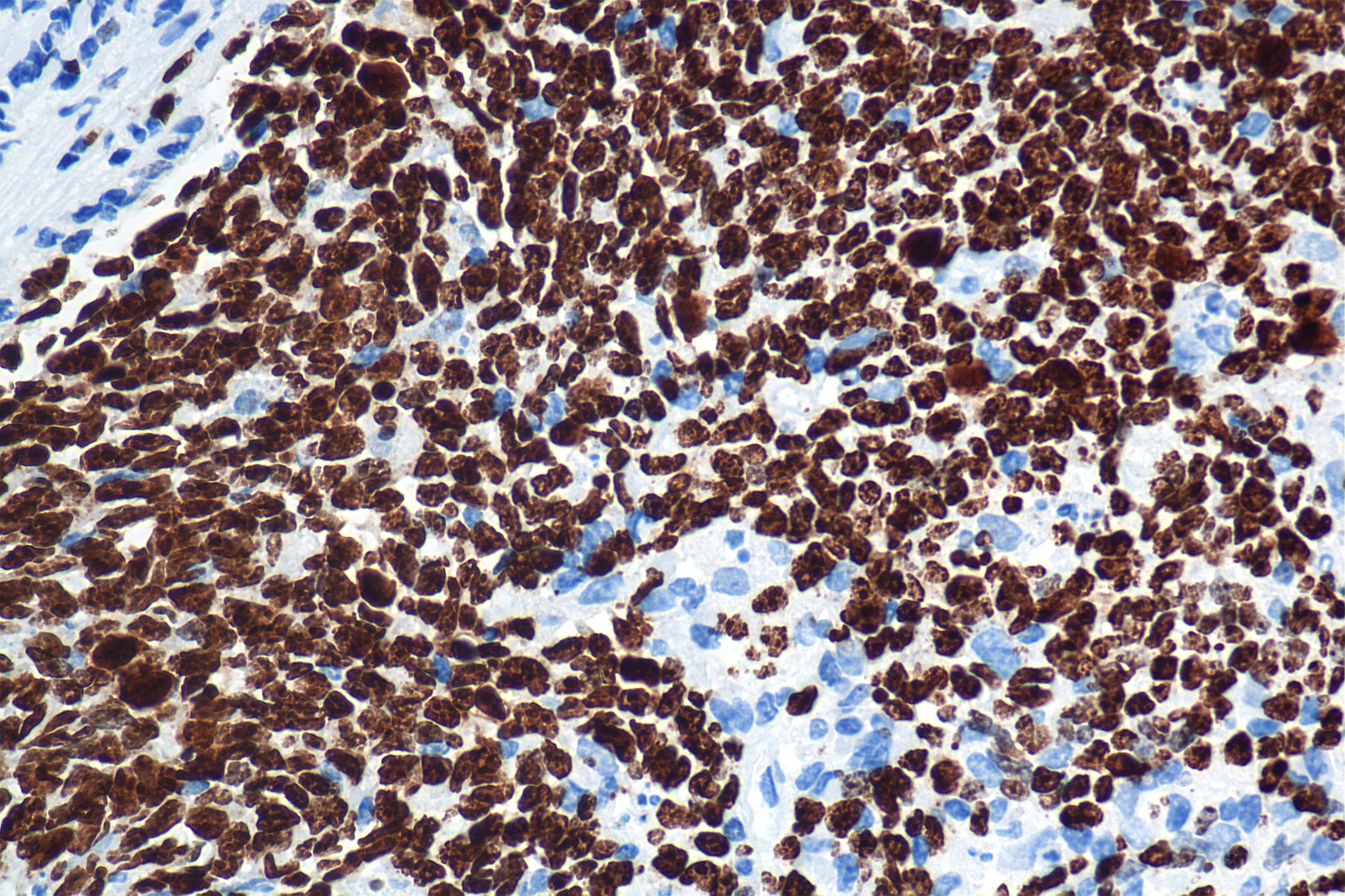 Immunohistochemical analysis of paraffin-embedded mouse heart tissue slide using HRP-PF00030 (HRP Streptavidin) at dilution of 1:500 (under 40X lens). Heat mediated antigen retrieval with Tris-EDTA buffer (pH 9.0).
一抗用的Biotin-conjugated Ki-67 Recombinant monoclonal antibody（批次：21024638）