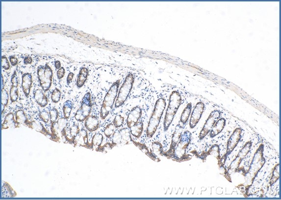 Immunohistochemical analysis of paraffin-embedded mouse colon tissue slide with anti-E-cadherin  ​Antibody(20874-1-AP) labeled with FlexAble HRP Antibody Labeling Kit for Rabbit IgG (KFA005). Antibody used at a dilution of 1:1000 under 10x and 40x lens.  Heat mediated antigen retrieval performed with Tris-EDTA buffer (pH 9.0) and DAB substrate was used for detection.