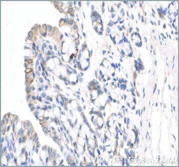 Immunohistochemical analysis of paraffin-embedded Rabbit colon tissue using anti-Cytokeratin 20 antibody (17329-1-AP) labeled with FlexAble Biotin Antibody Labeling Kit for Rabbit IgG (KFA007) and used at a dilution of 1:1000 (under 40x lens). Streptavidin Poly-HRP and DAB substrate was used for detection. Heat mediated antigen retrieval performed with Tris-EDTA buffer (pH 9.0).