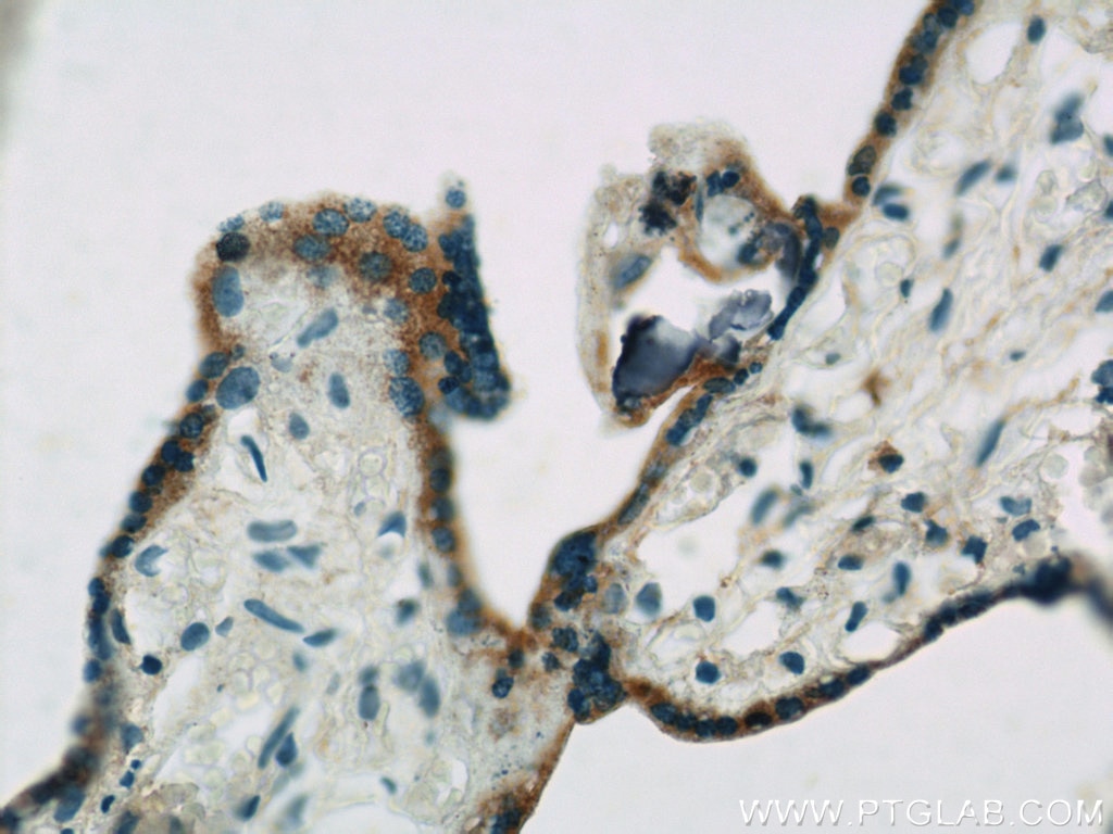 Immunohistochemical analysis of paraffin-embedded human placenta slide using 22401-1-AP (ACSL4 antibody at dilution of 1:50.