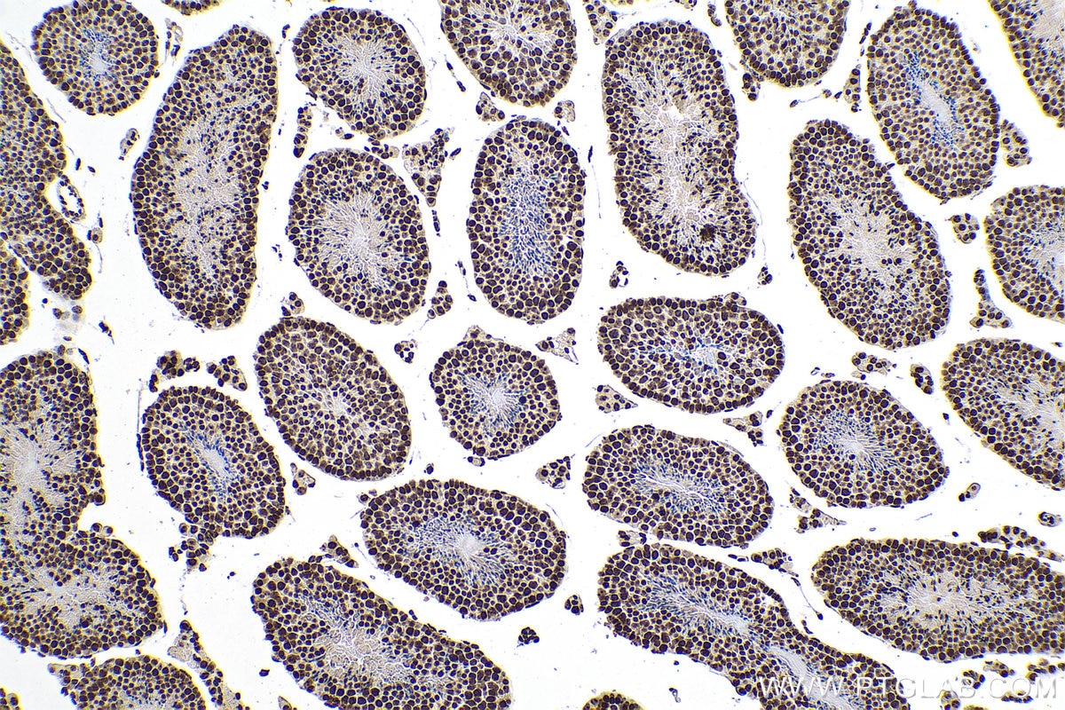 Immunohistochemical analysis of paraffin-embedded mouse testis tissue slide using 68301-1-Ig (m5C antibody) at dilution of 1:5000 (under 10x lens). Heat mediated antigen retrieval with Tris-EDTA buffer (pH 9.0).