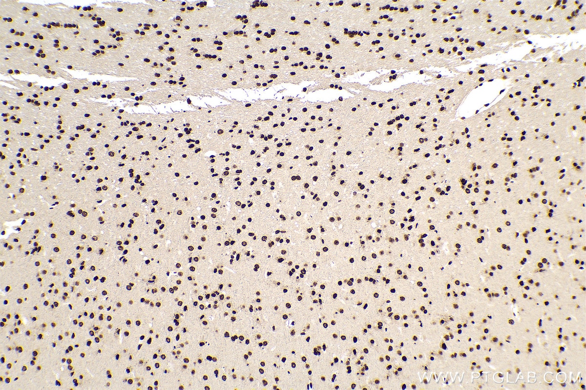Immunohistochemical analysis of paraffin-embedded rat brain tissue slide using 68301-1-Ig (m5C antibody) at dilution of 1:5000 (under 10x lens). Heat mediated antigen retrieval with Tris-EDTA buffer (pH 9.0).