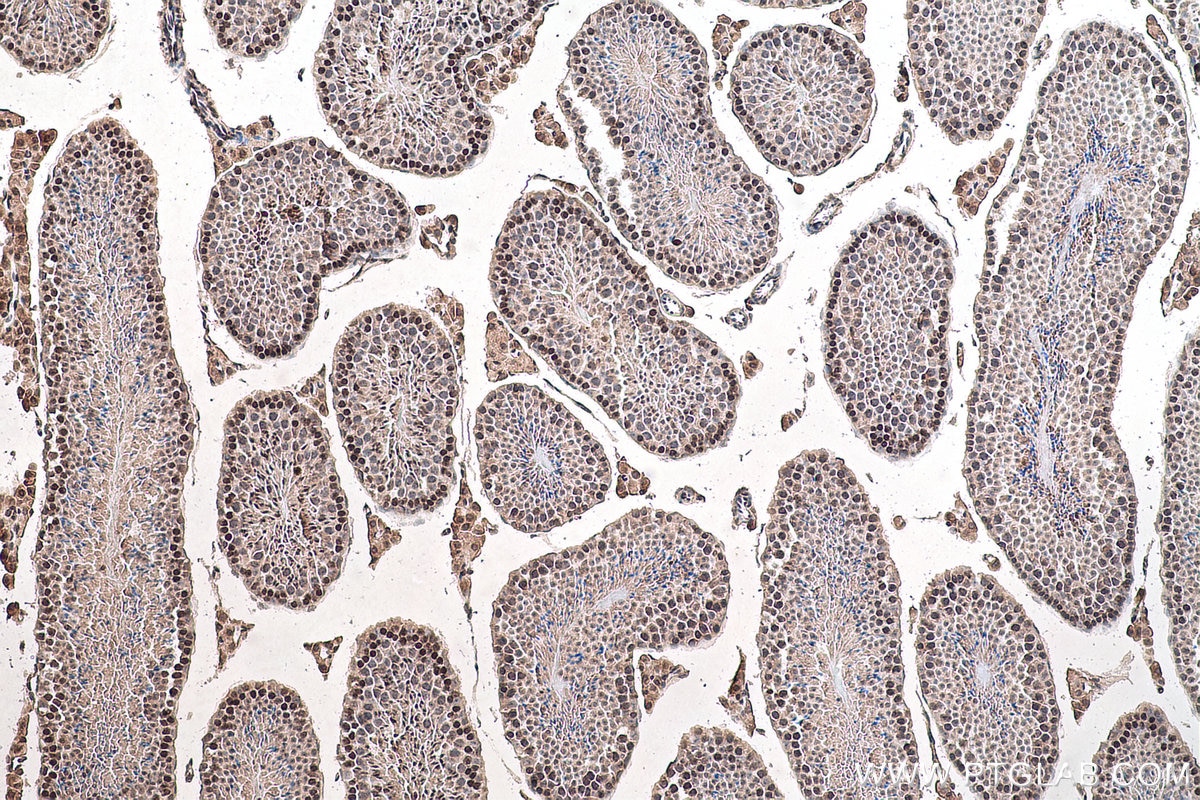 Immunohistochemical analysis of paraffin-embedded mouse testis tissue slide using 68302-1-Ig (m7G antibody) at dilution of 1:2000 (under 10x lens). Heat mediated antigen retrieval with Tris-EDTA buffer (pH 9.0).