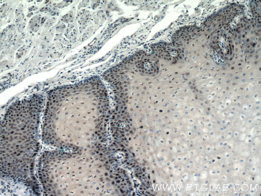 Immunohistochemical analysis of paraffin-embedded human oesophagus tissue slide using 16727-1-AP (TRMT6 Antibody) at dilution of 1:100 (under 10x lens).