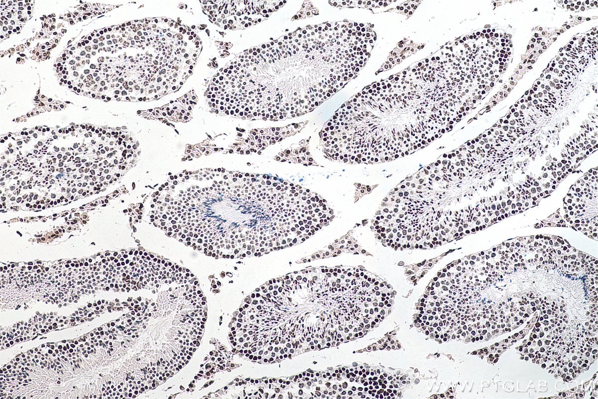 Immunohistochemical analysis of paraffin-embedded mouse testis tissue slide using 68055-1-Ig (m6A antibody) at dilution of 1:4000 (under 10x lens). Heat mediated antigen retrieval with Tris-EDTA buffer (pH 9.0).