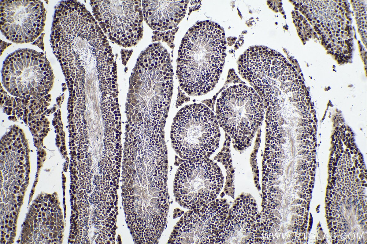 Immunohistochemical analysis of paraffin-embedded mouse testis tissue slide using 67811-1-Ig (ALKBH5 antibody) at dilution of 1:1000 (under 10x lens). Heat mediated antigen retrieval with Tris-EDTA buffer (pH 9.0).