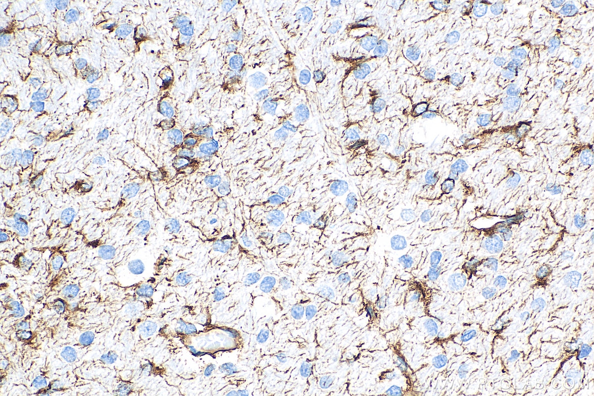 Immunohistochemical analysis of paraffin-embedded rat brain tissue slide using 81063-1-RR (GFAP antibody) at dilution of 1:9900 (under 40x lens). Heat mediated antigen retrieval with Tris-EDTA buffer (pH 9.0).