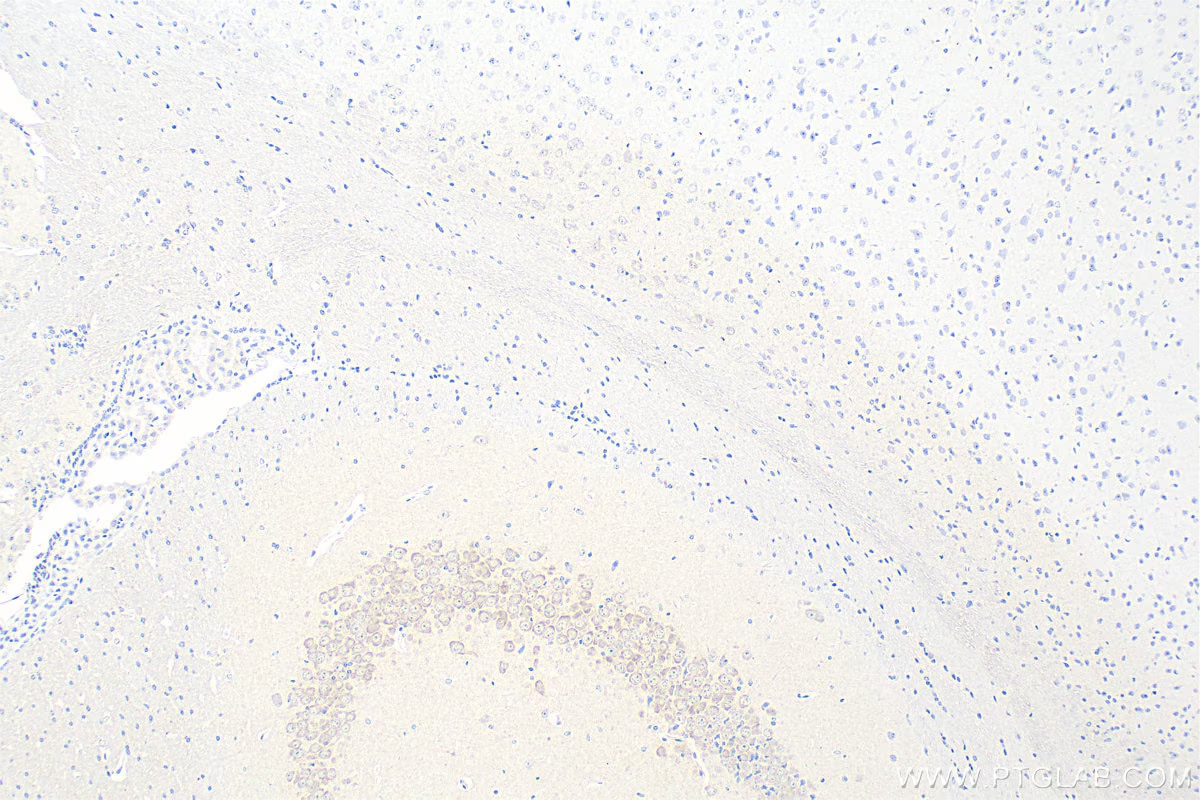 Immunohistochemical analysis of paraffin-embedded mouse brain tissue slide using 67298-1-Ig (LIAS antibody) at dilution of 1:1000 (under 10x lens). Heat mediated antigen retrieval with Tris-EDTA buffer (pH 9.0).