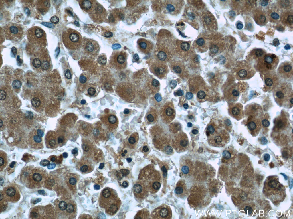 Immunohistochemical analysis of paraffin-embedded human liver tissue slide using 66119-1-Ig (PDH E1α antibody at dilution of 1:50(under 40x lens).