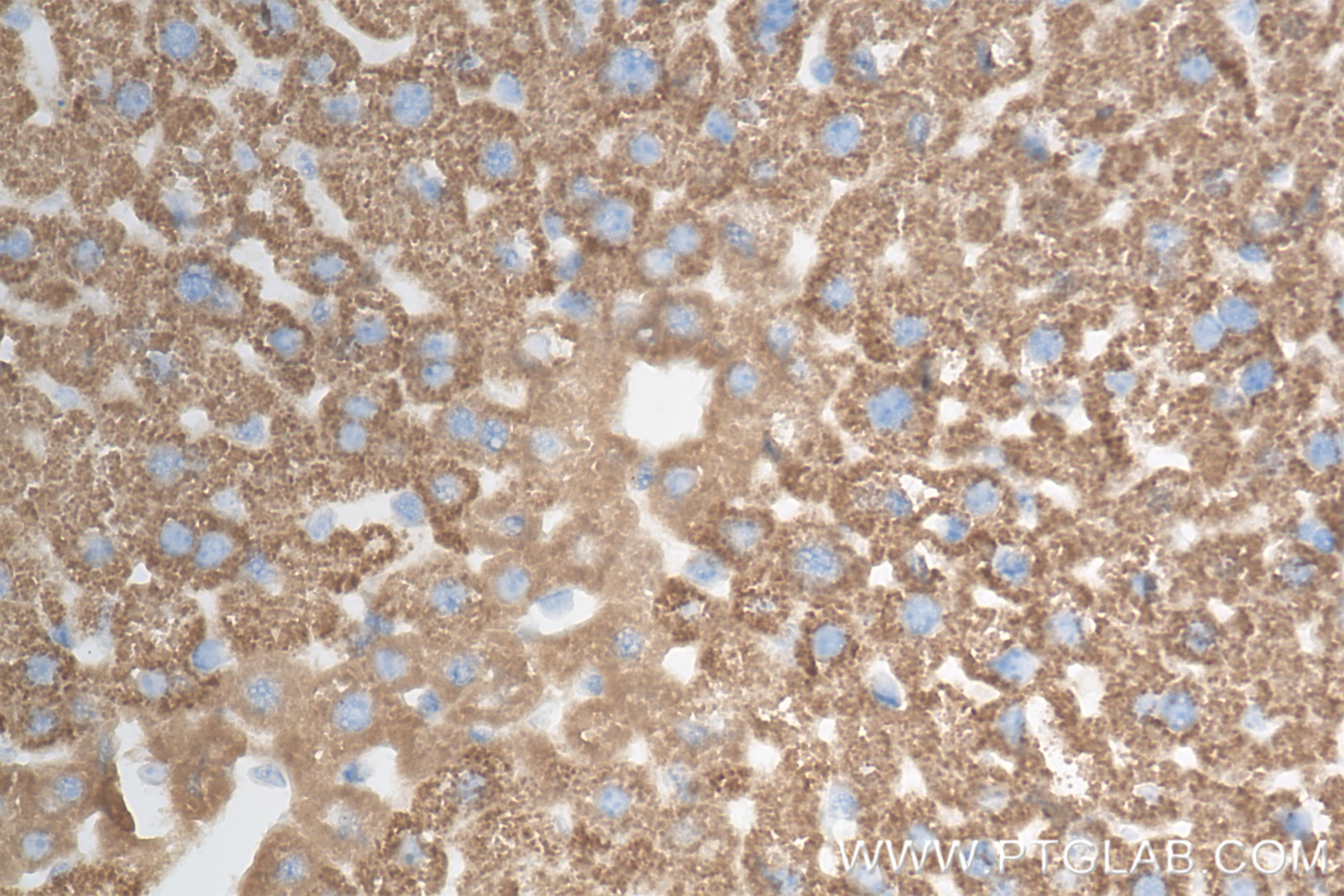Immunohistochemical analysis of paraffin-embedded mouse liver tissue slide using 85288-2-RR (ATP7B-Specific antibody) at dilution of 1:2000 (under 40x lens). Heat mediated antigen retrieval with Tris-EDTA buffer (pH 9.0).