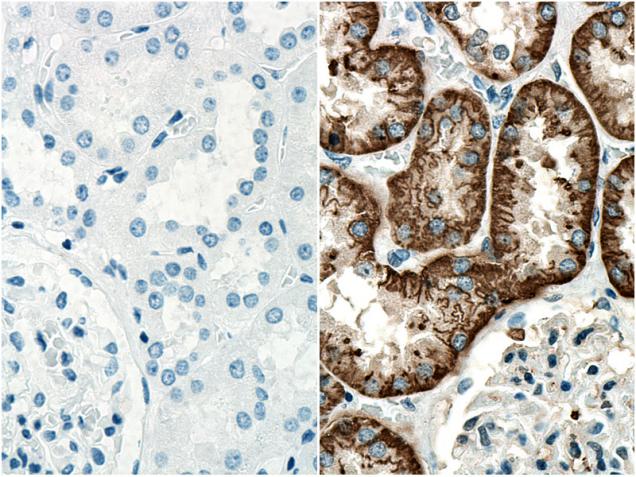 Immunohistochemistry analysis of paraffin-embedded human kidney tissue slide using PR30011 without (left) or with (right) primary antibody.